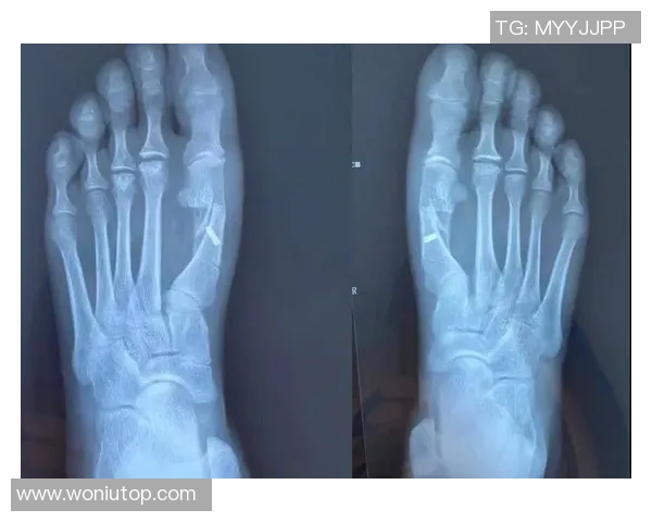 暂定4月初！尼记：麦克布莱德术后预计需要6-8周才能复出